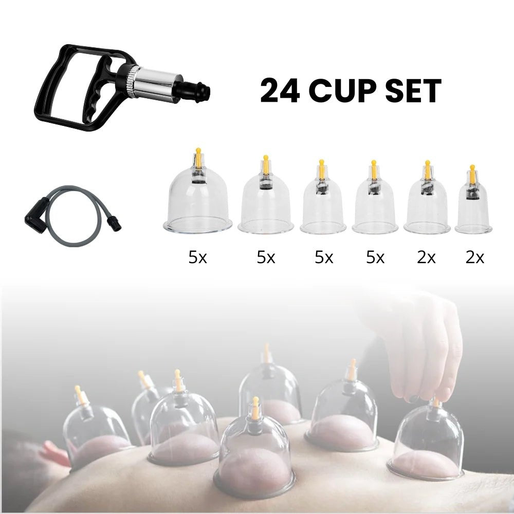 VitaCups – Premium Cupping Therapy Set